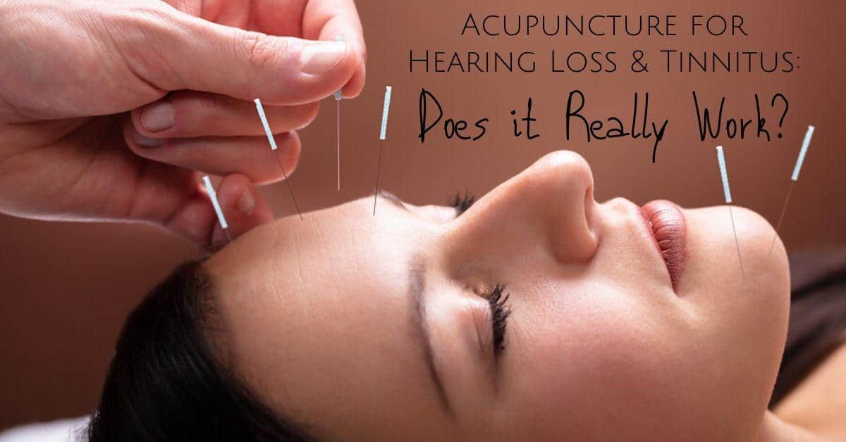 Featured image for “Acupuncture for Hearing Loss & Tinnitus: Does it Really Work?”