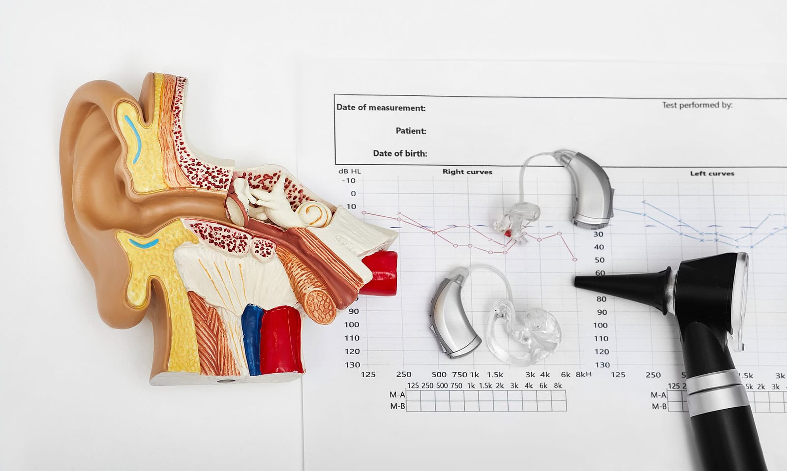 Types of Hearing Loss